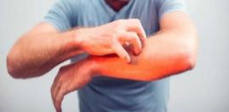 Nasır, egzama ve mantara 5 dakikada çözüm.