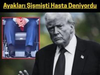 hastalığı neymiş