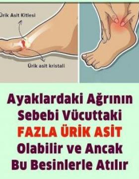 Ayaklardaki ağrı sebebi