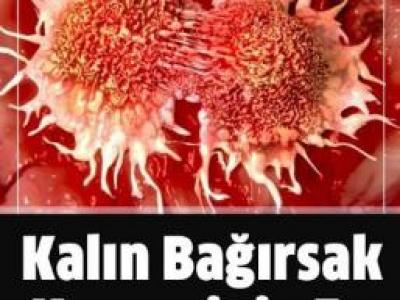 Kalın bağırsak kanseri