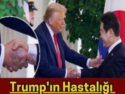 Trump’ın elindeki morlukların sebebi