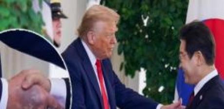 Trump’ın elindeki morlukların sebebi