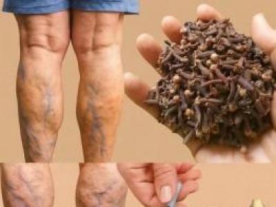 Bacak ağrısı, romatizma, varis, artrit