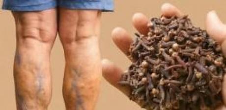 Bacak ağrısı, romatizma, varis, artrit