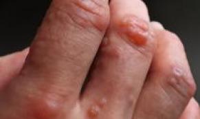 Kolunuzdaki Bu Küçük Kırmızı