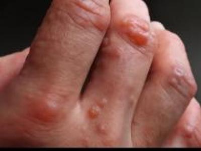 Kolunuzdaki Bu Küçük Kırmızı