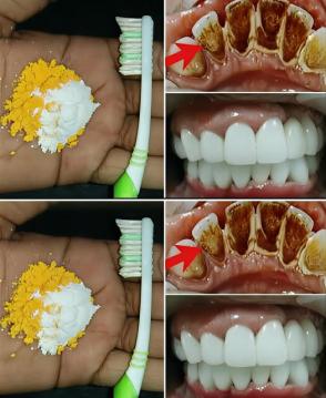 İşte Zehra'nın Kazandığı Okul!