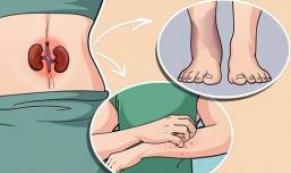 Böbrek Hastalığının 7 Belirtisi