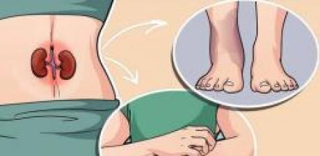 Böbrek Hastalığının 7 Belirtisi