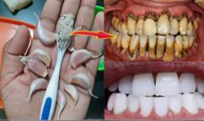 Diş Hekimlerinin bilmenizi istemediği sır