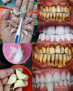 İşte Zehra'nın Kazandığı Okul!