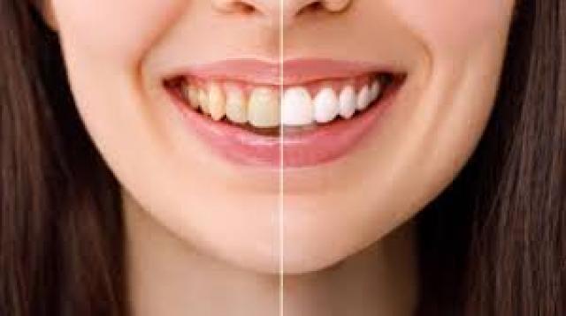 İşte Zehra'nın Kazandığı Okul!