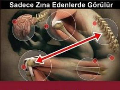 Zina Eden Birine Bu 3 Hastalığı Mutlaka verir.