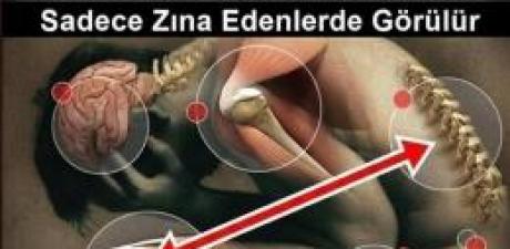 Zina Eden Birine Bu 3 Hastalığı Mutlaka verir.