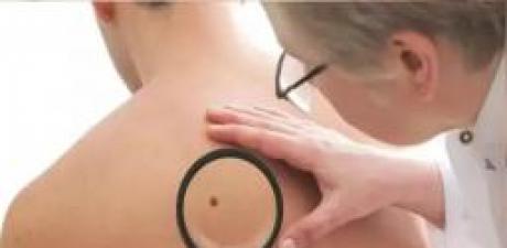 Son yıllarda artan vakalarla birlikte uzmanların sık sık uyardığı