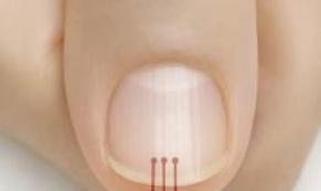 40 Yaşından Sonra Tırnağınızda Böyle Çizgiler Varsa işarettir