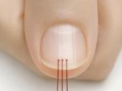 40 Yaşından Sonra Tırnağınızda Böyle Çizgiler Varsa işarettir