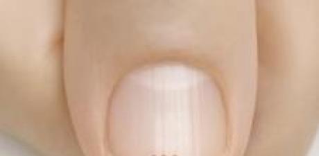 40 Yaşından Sonra Tırnağınızda Böyle Çizgiler Varsa işarettir