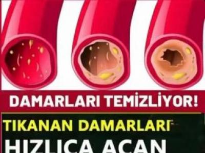 Damar Tıkanıklığını Önleyen Gıdalar