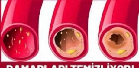 Damar Tıkanıklığını Önleyen Gıdalar