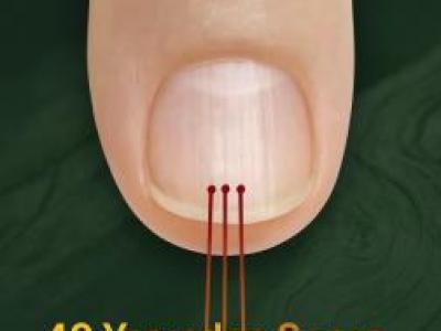 Tırnaklarınızdaki Dikey Çizgiler