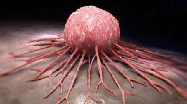 İşte Zehra'nın Kazandığı Okul!