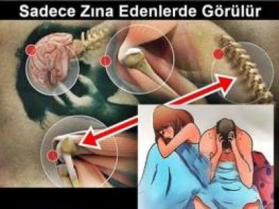 sadece onlarda görülür