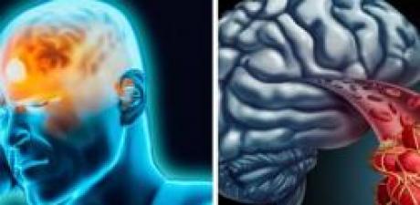 Pıhtı atmasını önlemek için neler yapılabilir