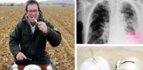 Her gün aç karnına sarımsak yiyen adamın başına gelenler