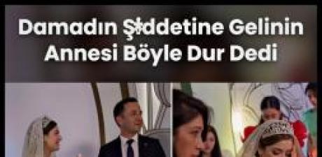 damadın yaptığına bakın