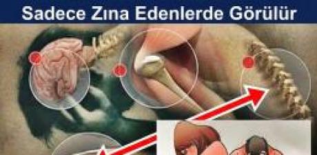 Zina Eden 
