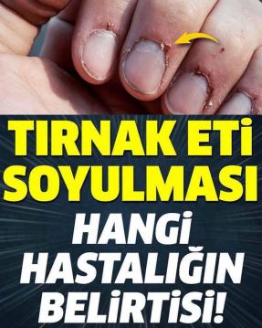 İşte Zehra'nın Kazandığı Okul!