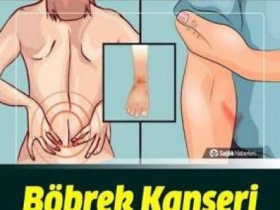 Böbrek Kanserinin Belirtileri