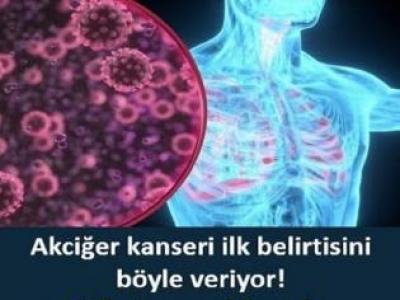  İşte akciğer kanserinin
