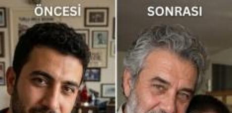 EŞİM, YENİ DOĞAN OĞLUMUZUN DOWN SENDROMU